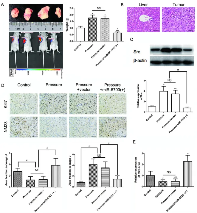 壓力響應(yīng)型 miRNA - 5703 的過(guò)表達(dá)抑制壓力誘導(dǎo)的肝癌生長(zhǎng)和轉(zhuǎn)移