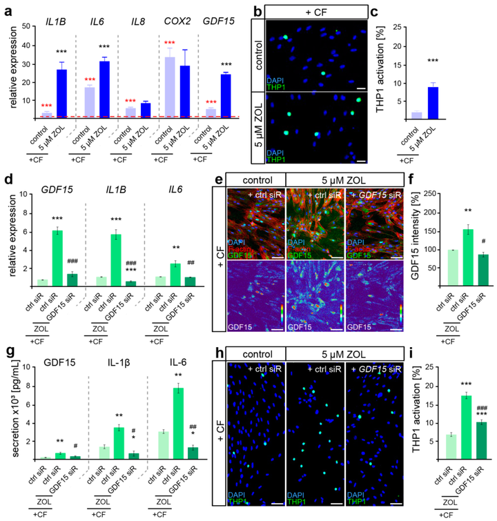GDF15 調(diào)節(jié)唑來(lái)膦酸誘導(dǎo)的牙周膜成纖維細(xì)胞的高炎機(jī)械反應(yīng)