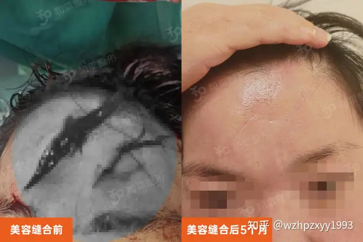 事发温州!一家长深夜驱车3小时,只为孩子这件事