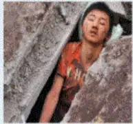 挤压综合征是如何形成的？ - 知乎