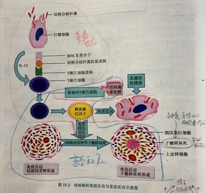 koch现象有合理的解释么,为什么说变态反应和免疫力不是一码事? - 知乎