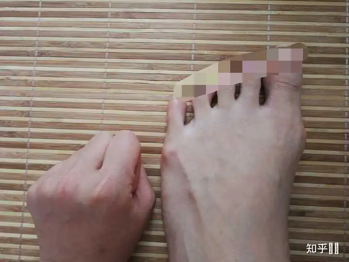 为什么脚会宽?脚宽可以后天改变么? - 知乎