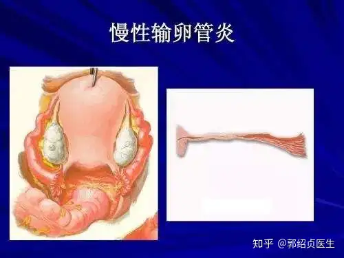 庙肥抽炎——慢妥诬娇永炕弧！(图3)