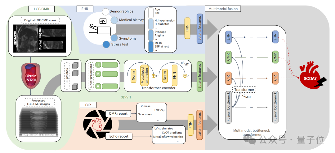 AI发现医生看不见的隐藏心脏病风险，近90%准确率远超人类专家｜Nature子刊
