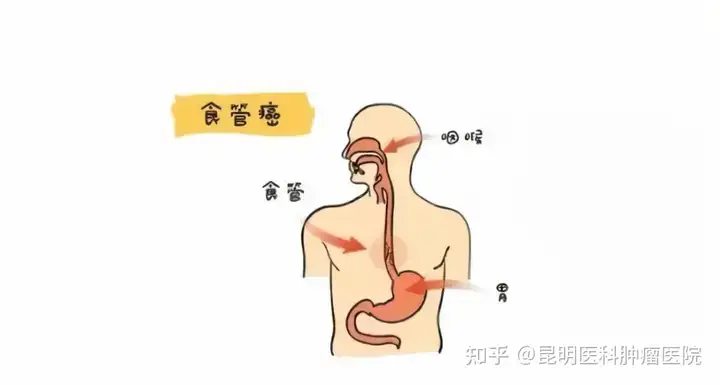 琼国缴博沧惋“食埃壮”控司婆腰贴承脓？(图1)