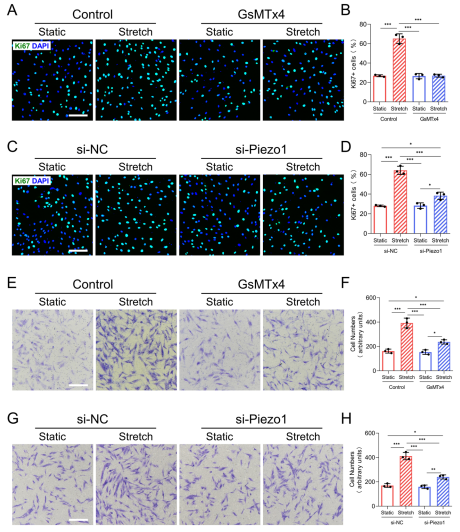 機(jī)械牽張通過機(jī)械激活的陽離子通道 Piezo1 促進(jìn)增生性瘢痕的形成