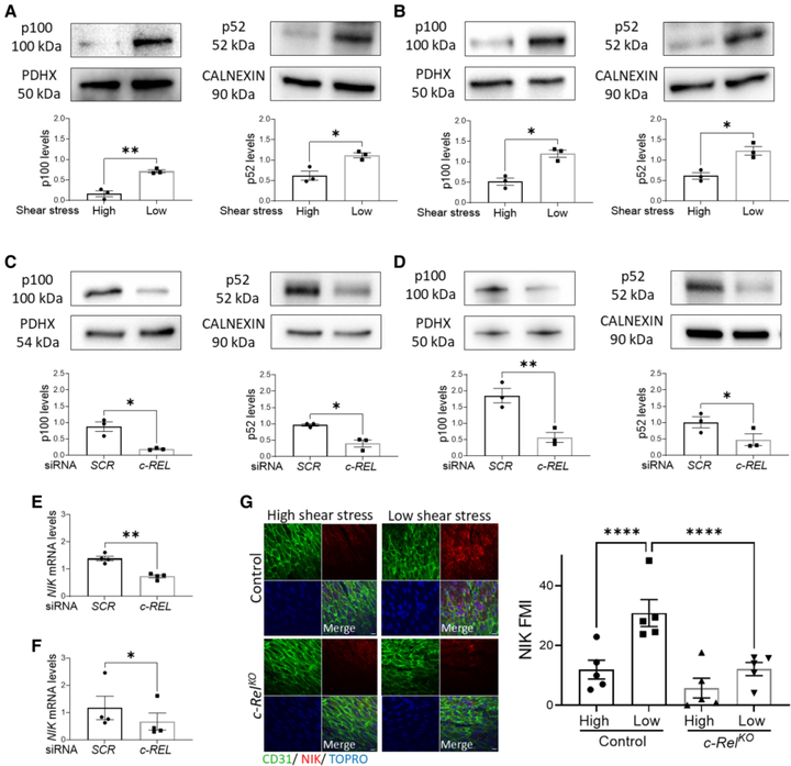 內皮 c-REL 通過與 TXNIP-p38 和非經典 NF-κB 通路的串擾在血流紊亂區域協調動脈粥樣硬化