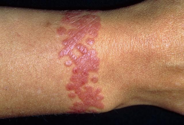 被盗的时候莫名其妙出现了这个问题