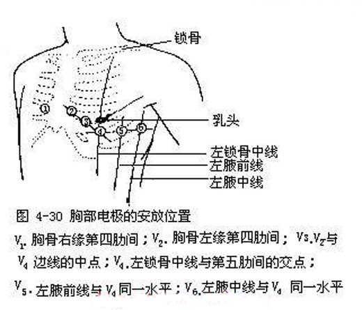 女生去做心电图的步骤图片