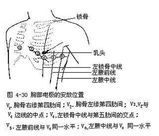 女生做心电图需要脱内衣吗? - 知乎