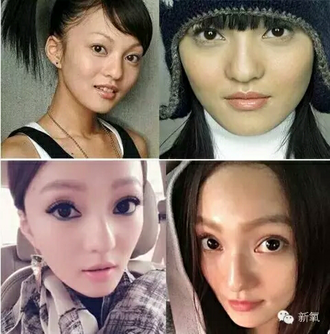 有哪些明星整容过度?