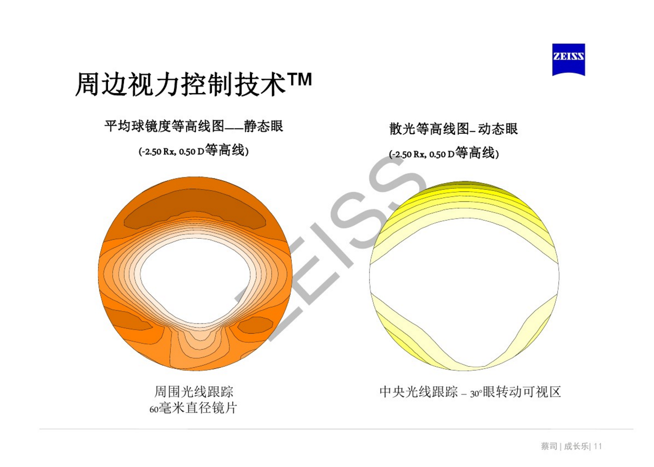 離焦鏡是什麼原理真的可以緩解近視嗎