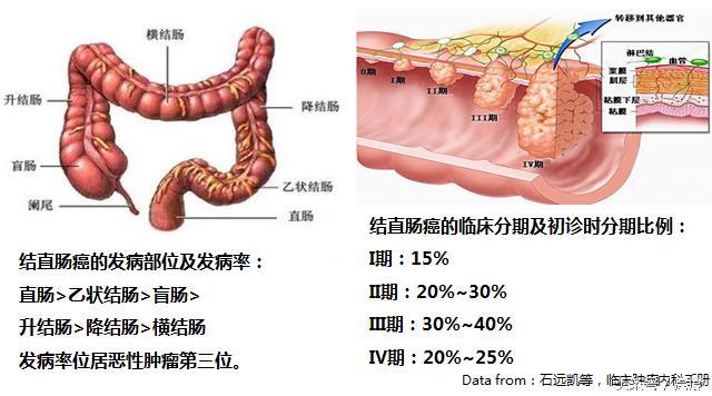 结直肠癌的发生、预防以及靶向治疗- 知乎