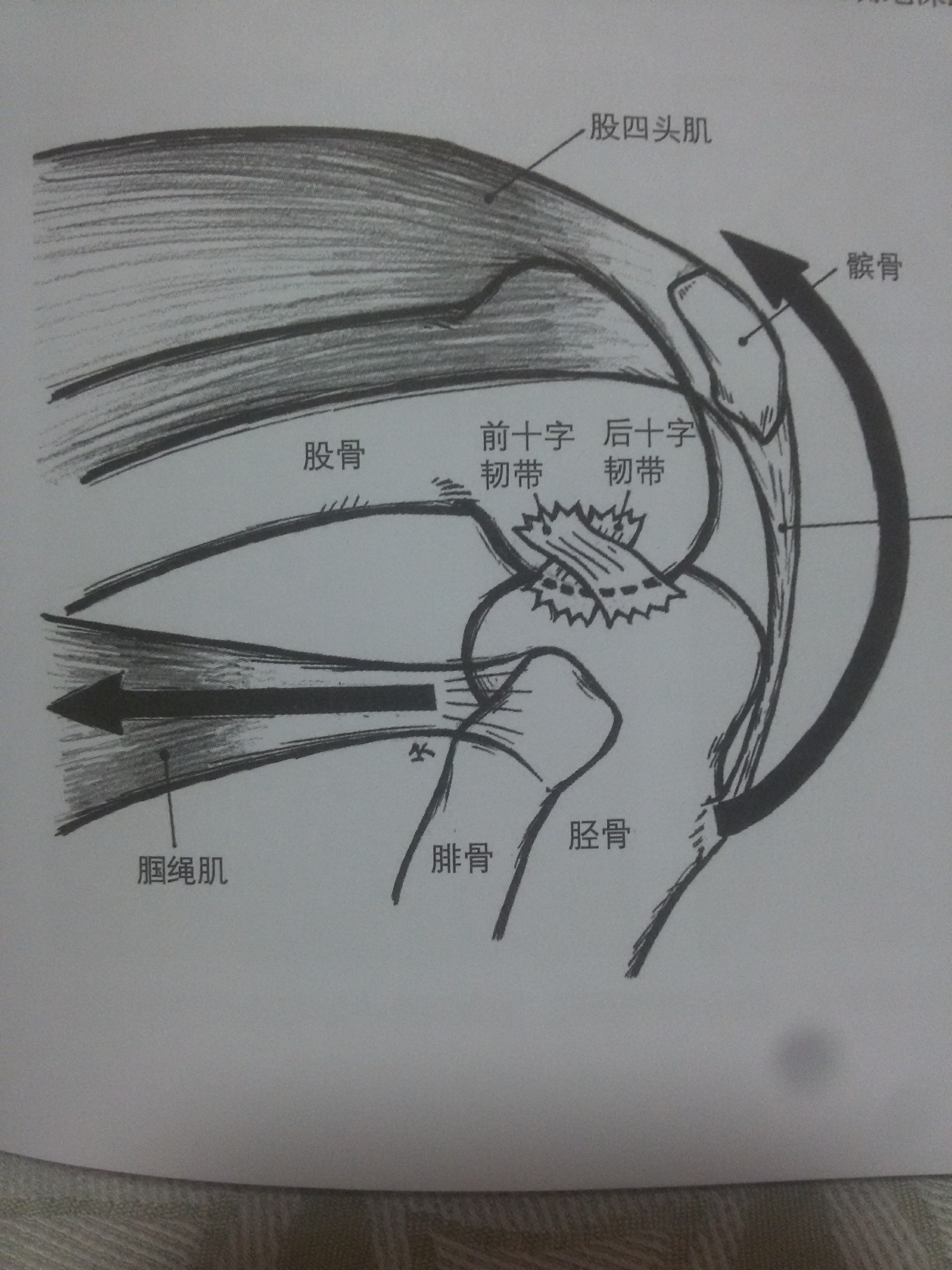 如何解决深蹲蹲到底部发动时单侧膝盖会痛的情况