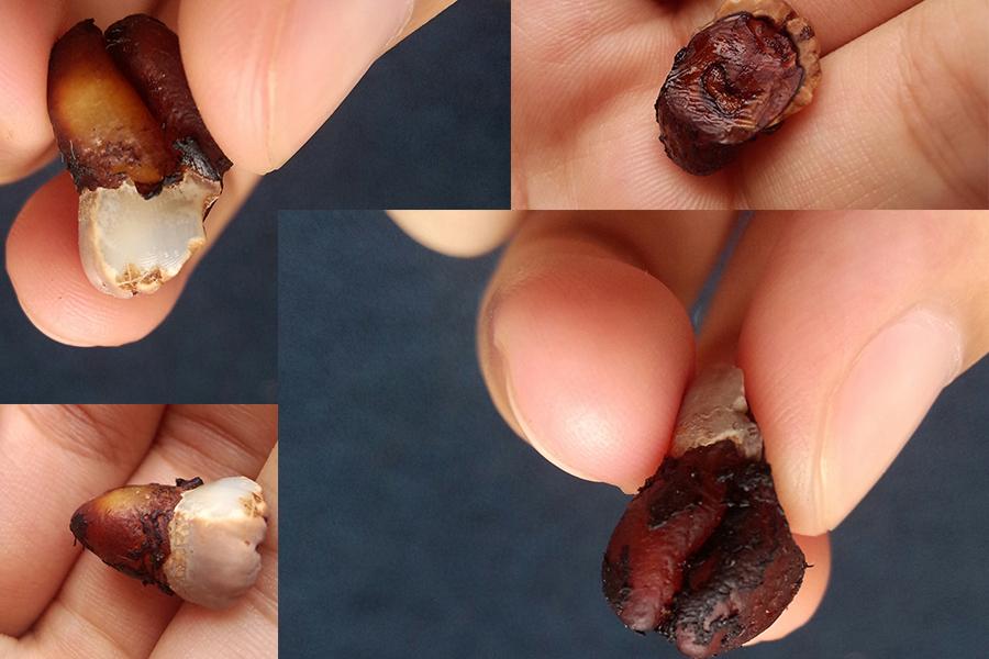 小鱼刺卡喉咙几天会腐烂脱落为什么在线