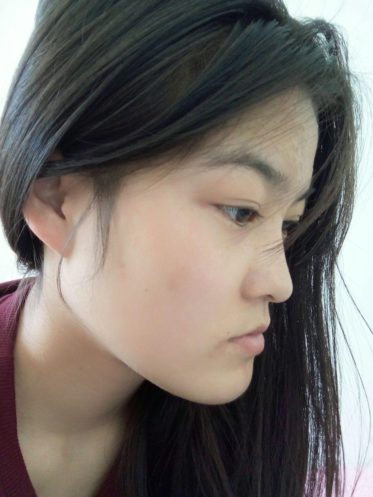 牙齿地包天兜齿是怎样的一种体验