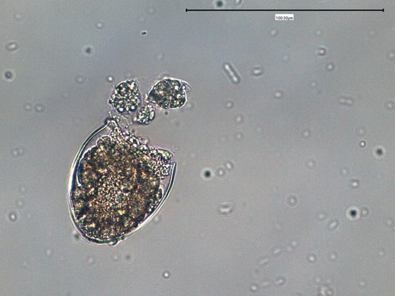 放大500倍的电子显微镜能否查看裂头蚴虫卵? - 知乎
