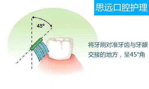 巴氏刷牙法的牙刷刷毛与牙龈成45度是什么意思