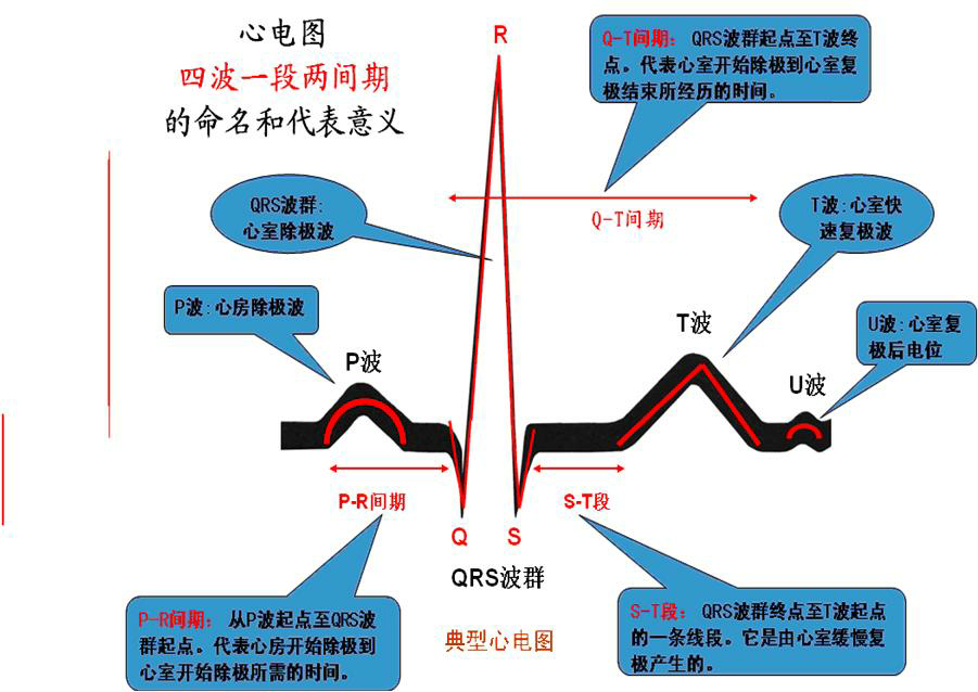 心電圖有沒有好的記憶口訣啊還有就是比較生動形象的例子