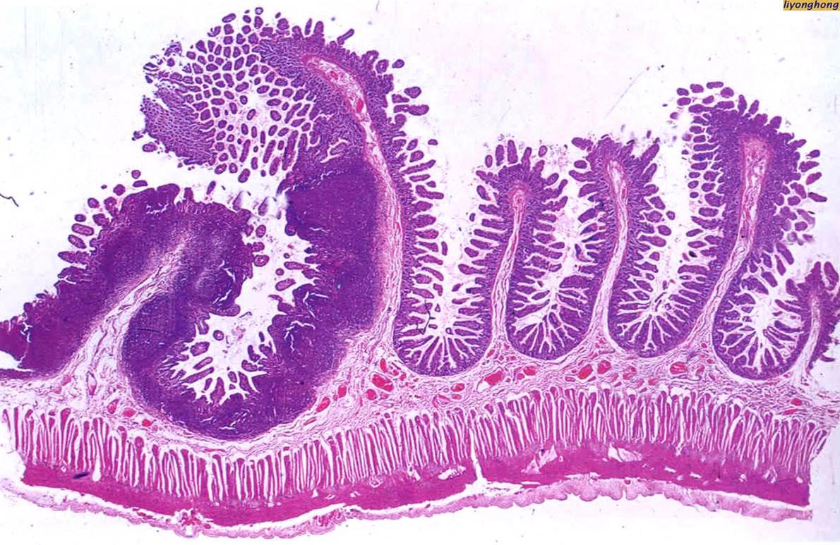 小肠环形皱襞图片图片