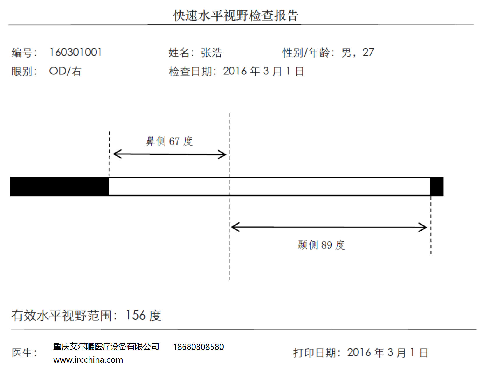 水平视野150度图解图片