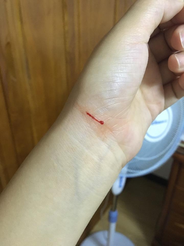 被学校里的猫轻微划伤(有图)要打疫苗吗?