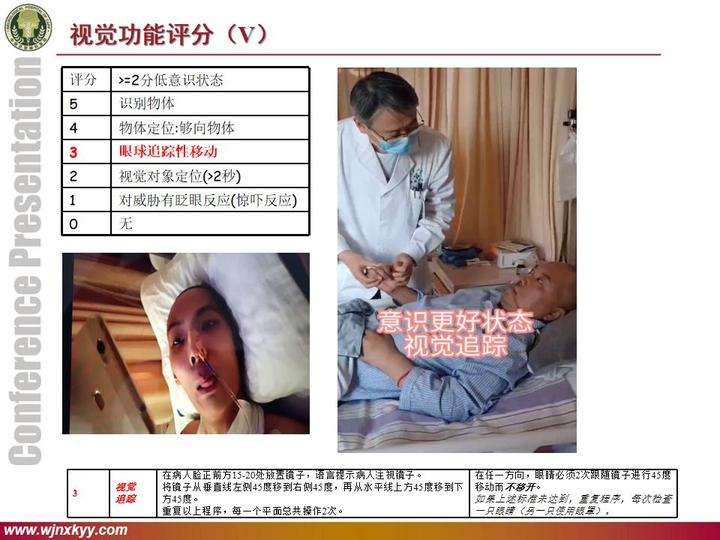 如何评估长期昏迷不醒病人的意识状态 - 知乎
