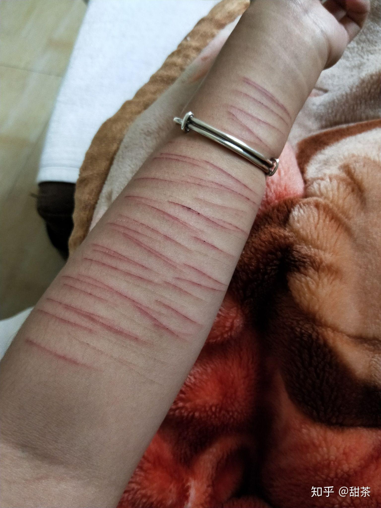 自残属于什么心理