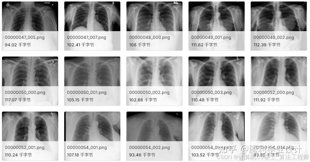 训练YOLOv8模型_胸部x光片检测数据集 且构建一个基于YOLOv8的胸部X光片检测系统 voc_yolo 深度学习目标检测来训练胸部x光片 ...