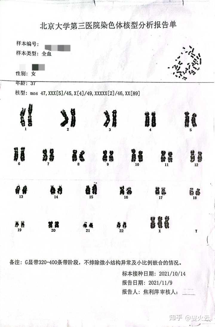 真的存在超雌女性吗?有没有例子?据说是长的比一般女性更美丽,但是可能经期会提前结束,或者影响智力。? - 知乎
