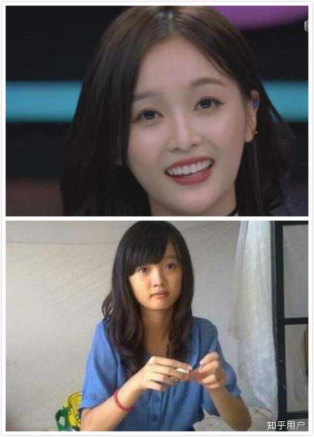 吴宣仪整容了吗