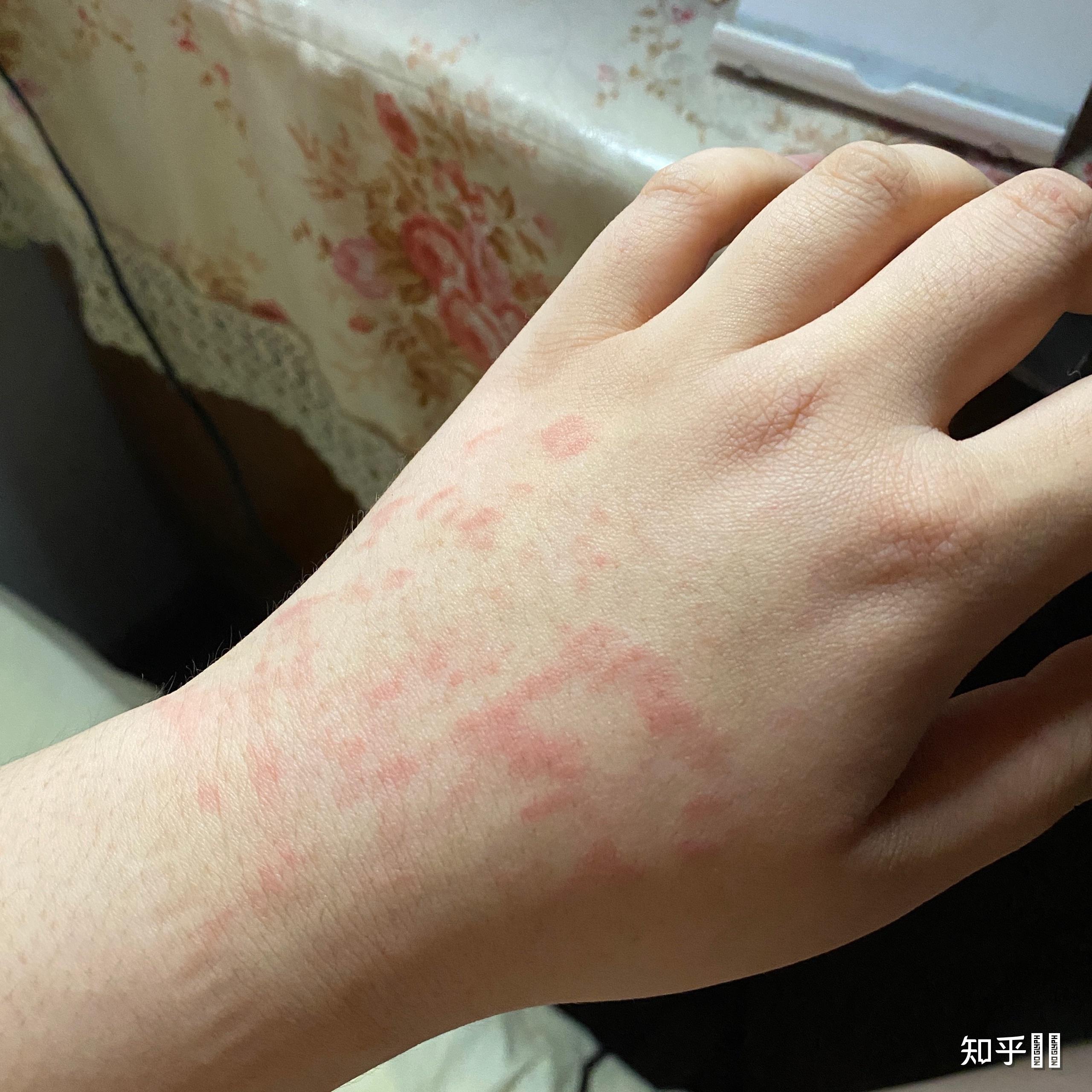 生气难过的时候喜欢用力掐自己的手或者用指甲抠自己的手为什么