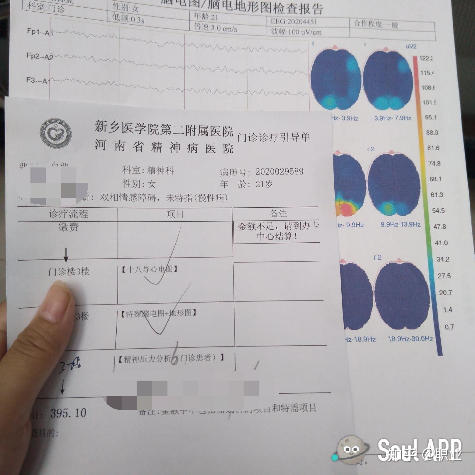 脑电图报告模板图片