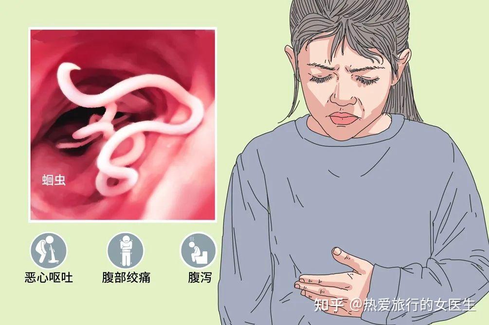 人体寄生虫有多少种? - 知乎