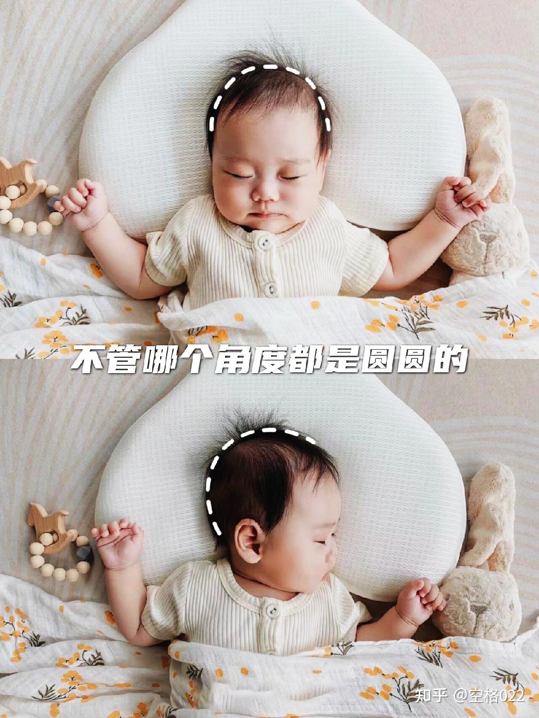 宝宝后脑勺出现枕秃是正常现象，但如果是这个原因，家长必须重视-今日头条