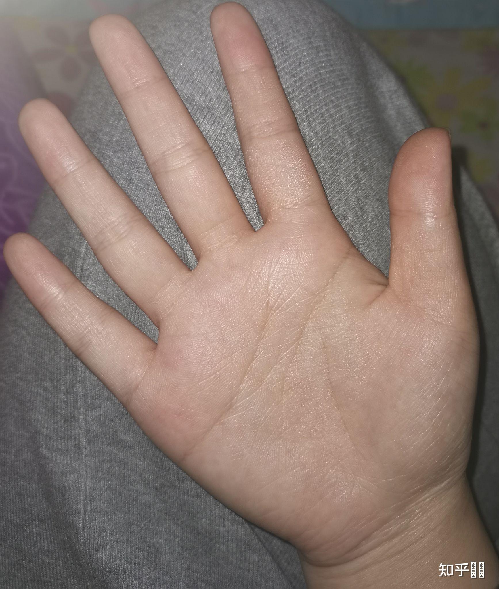 女生的手丑成这样怎么办? - 知乎