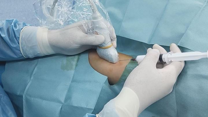 超声引导下血管瘤药物注射硬化治疗