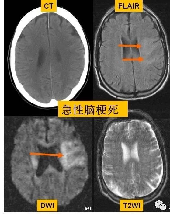 58-mri