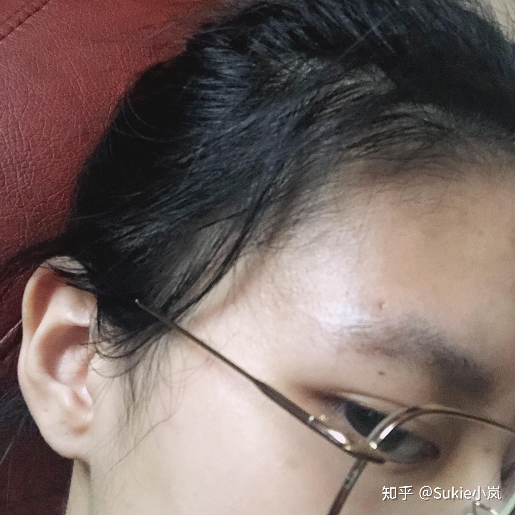 打眉钉是什么体验? - 知乎