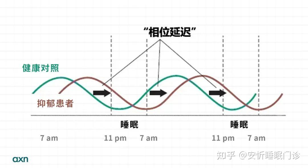 抑郁、双相障碍患者睡不好，如何改善？ 知乎 