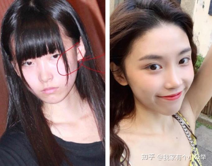 谁有半藏森林以前的照片