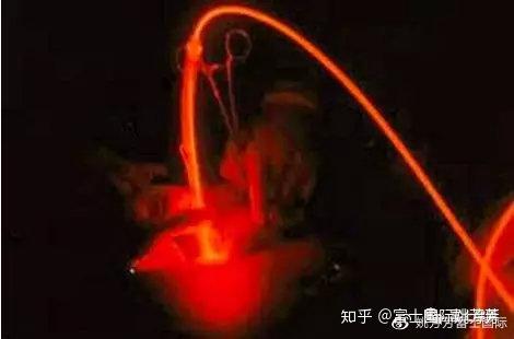 【科普园地】光动力疗法（PDT）与癌症治疗 - 知乎