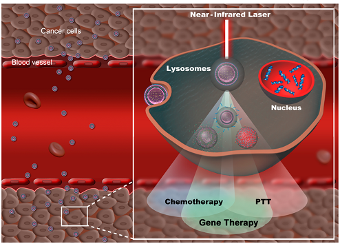 让肿瘤变热中科大研制智能光热材料有效增强抗癌效果