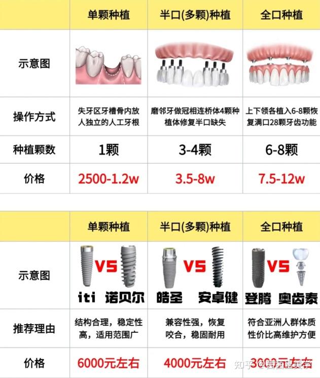 为什么种植牙很贵?