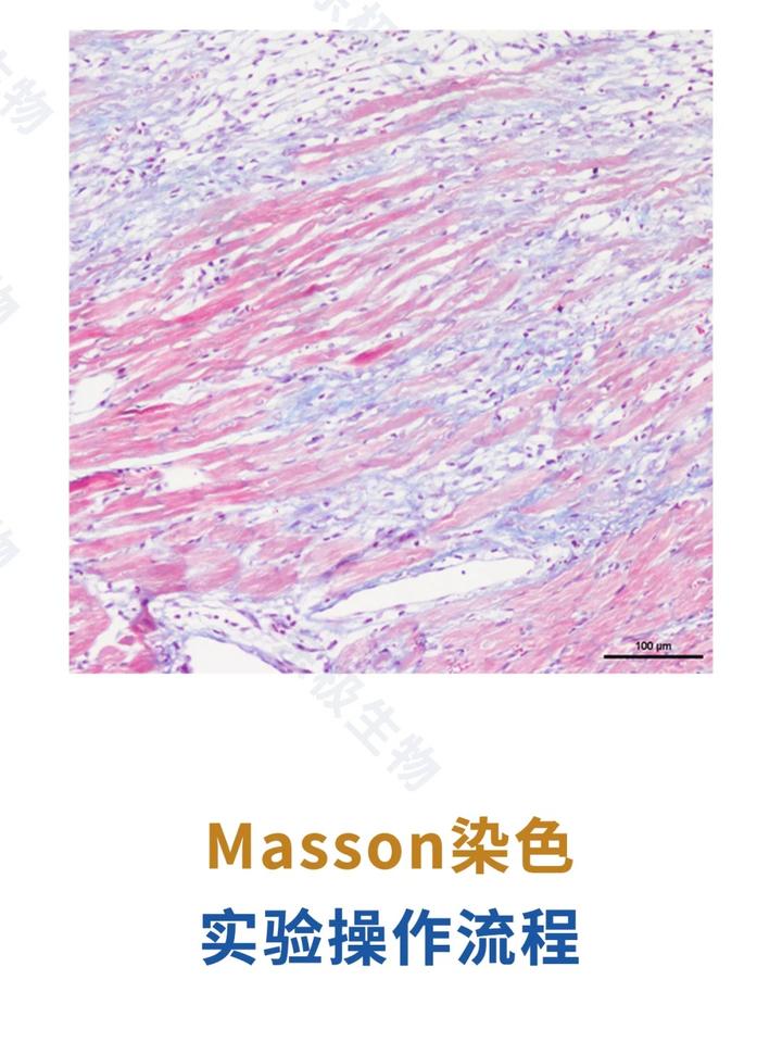 组织病理学分享——Masson染色实验操作流程 - 知乎