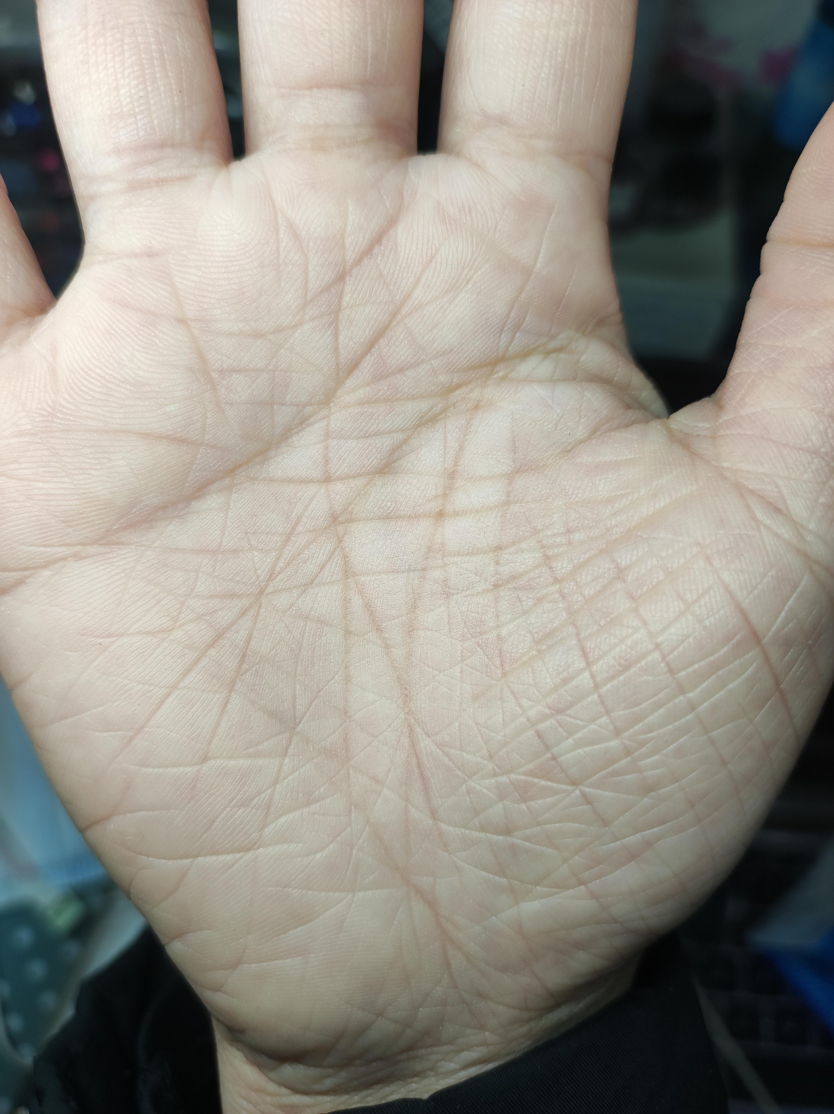 手掌天生粗糙纹路多 有希望解决吗? - 知乎