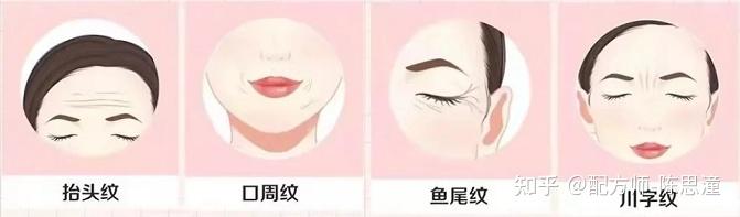 面部皱纹的分类和形成原因是什么?如何科学除皱? - 知乎