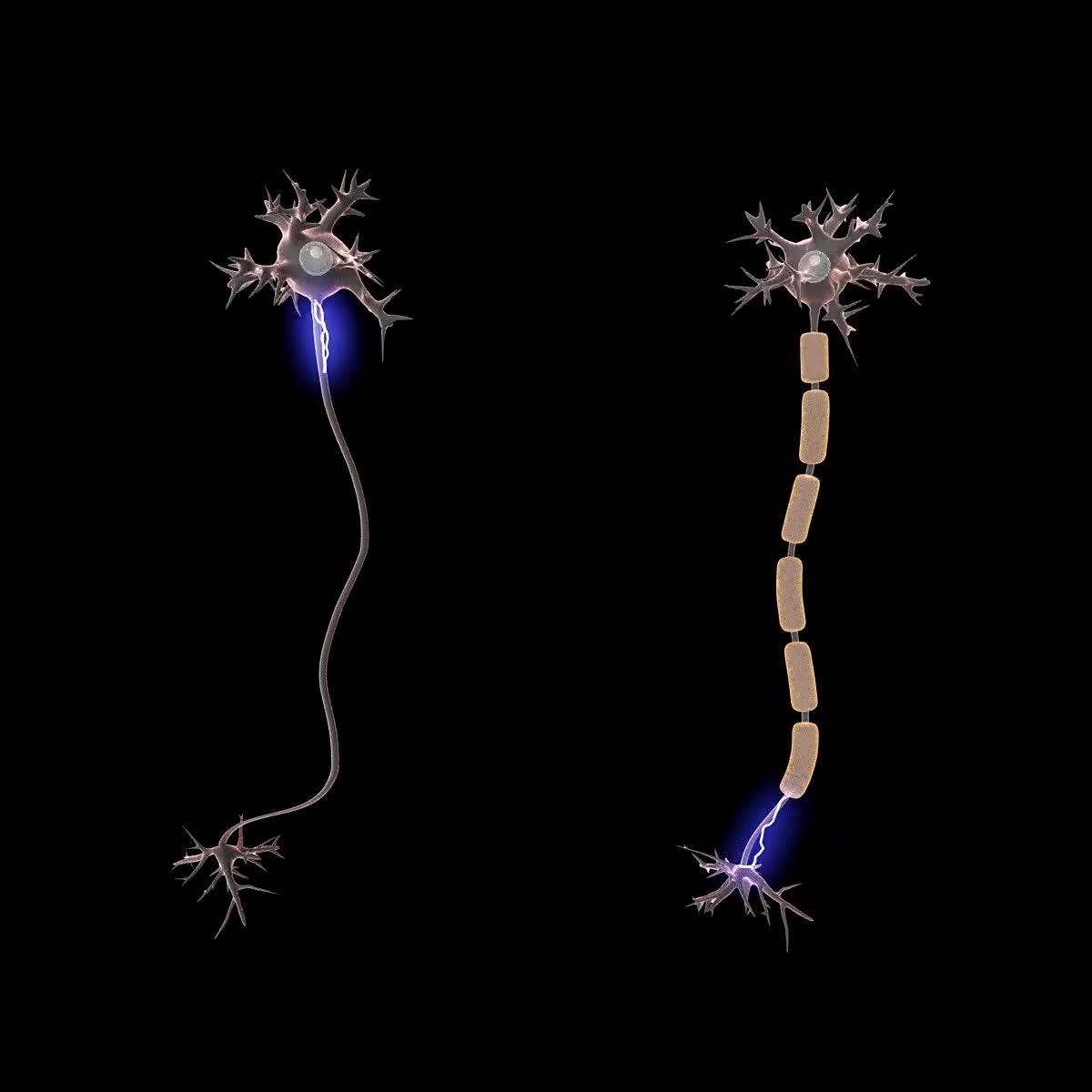 郎飞结:为什么有髓神经纤维的跳跃式传导比无髓的快呀,有么有通俗一点