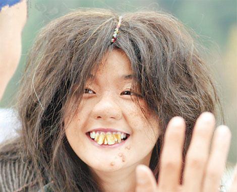 三招拥有一口大白牙不再担心牙黄问题