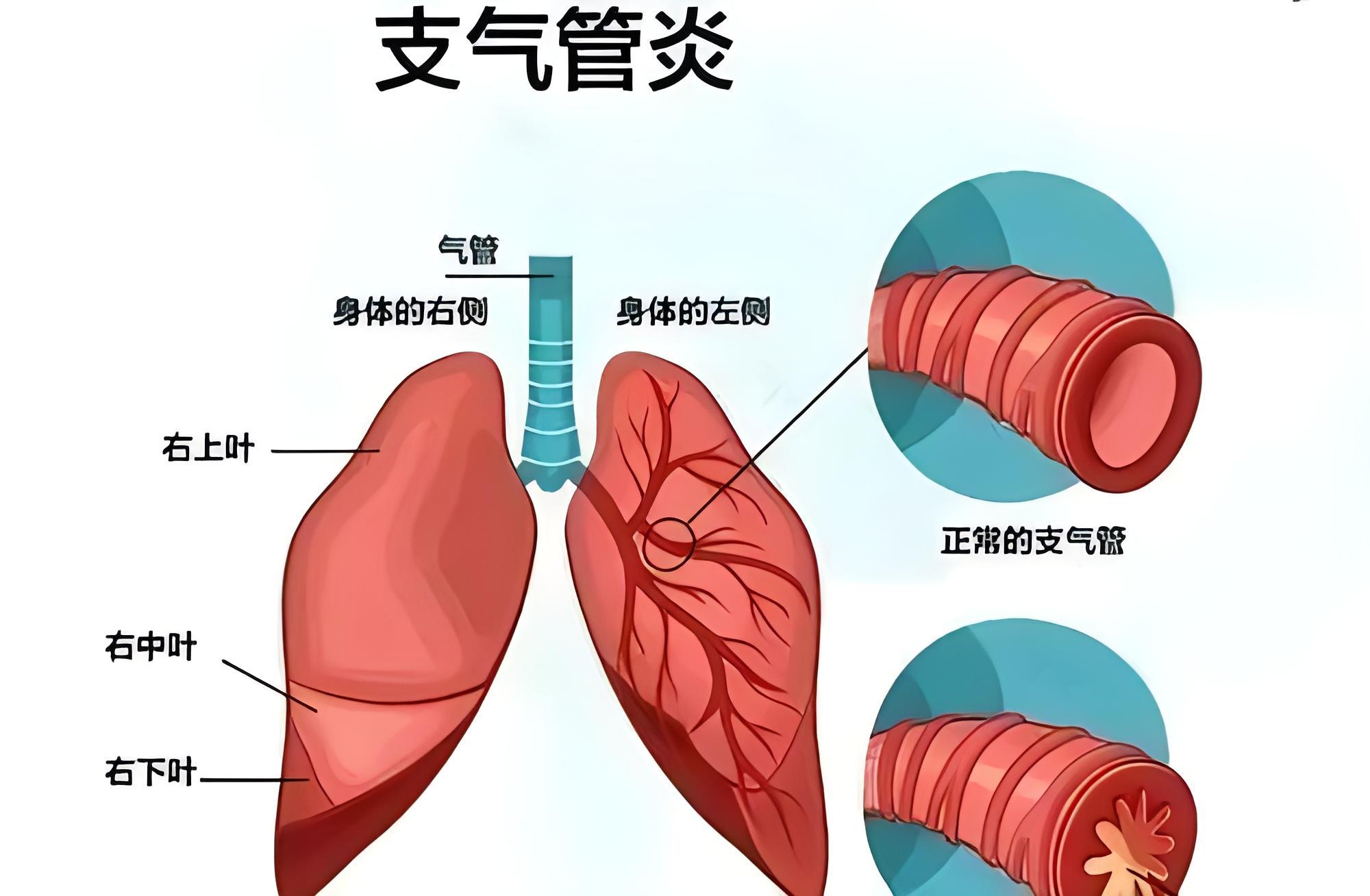 支气 知乎